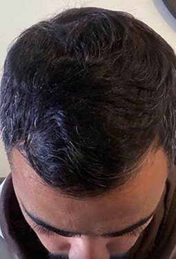 Customer hair after using SH1
