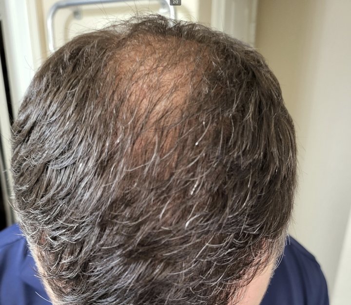 Customer hair after using SH1