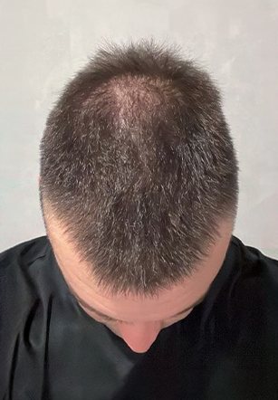 Customer hair before using SH1